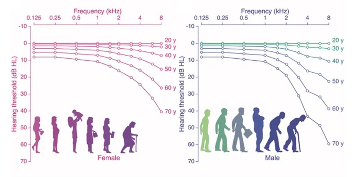 연령대별/성별 청력 감소 그래프